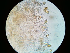 Galerina stordalii