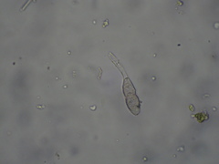 Puccinia circaeae