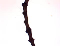 Lemanea