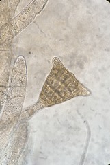 Sphacelaria tribuloides