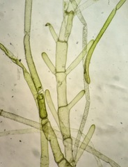 Cladophoropsis membranacea