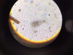 Euglypha