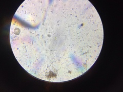 Staurodesmus extensus