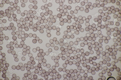 Microbotryum saponariae