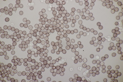 Microbotryum saponariae