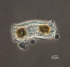 Achnanthes subconstricta