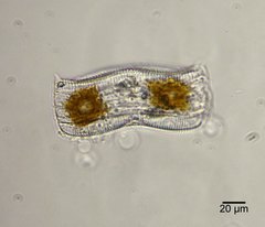 Achnanthes subconstricta