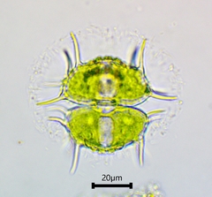 Xanthidium antilopaeum