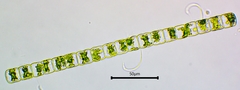 Hyalotheca