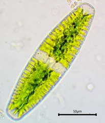 Netrium digitus