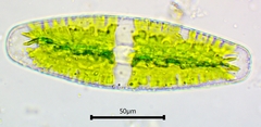 Netrium digitus