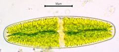 Netrium digitus