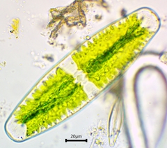 Netrium digitus