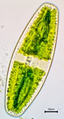 Netrium digitus