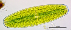 Netrium digitus