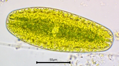 Netrium digitus
