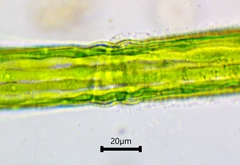 Pleurotaenium trabecula