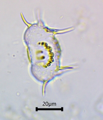 Xanthidium antilopaeum