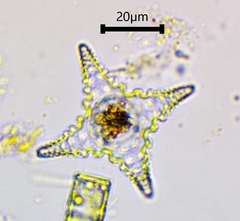 Staurastrum cerastes