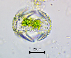 Staurastrum cerastes