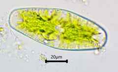 Netrium digitus