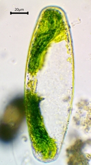 Netrium digitus