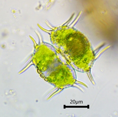 Xanthidium antilopaeum