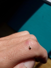 Sennius lateapicalis