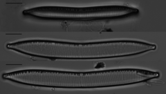 Hantzschia amphioxys