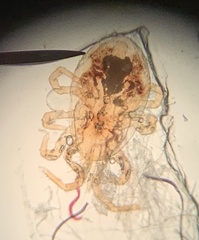 Ornithonyssus sylviarum