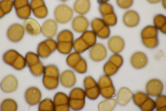 Puccinia acetosae
