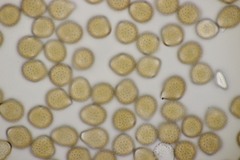 Puccinia chaerophylli retifera