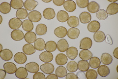 Puccinia chaerophylli retifera