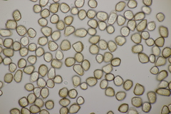 Thecaphora saponariae