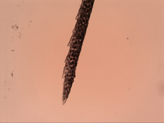 Dicranoloma menziesii