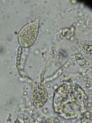 Exidiopsis calcea