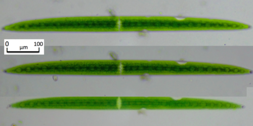 Closterium acerosum var. elongatum