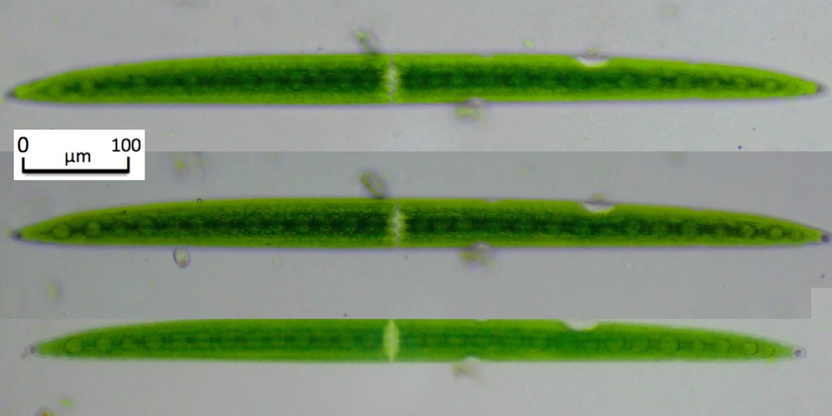 Closterium acerosum var. elongatum