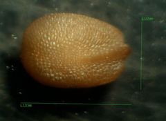 Petrorhagia nanteuilii
