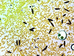 Phragmidium mucronatum