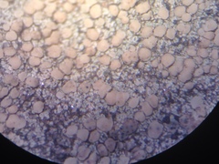 Lecanora polytropa