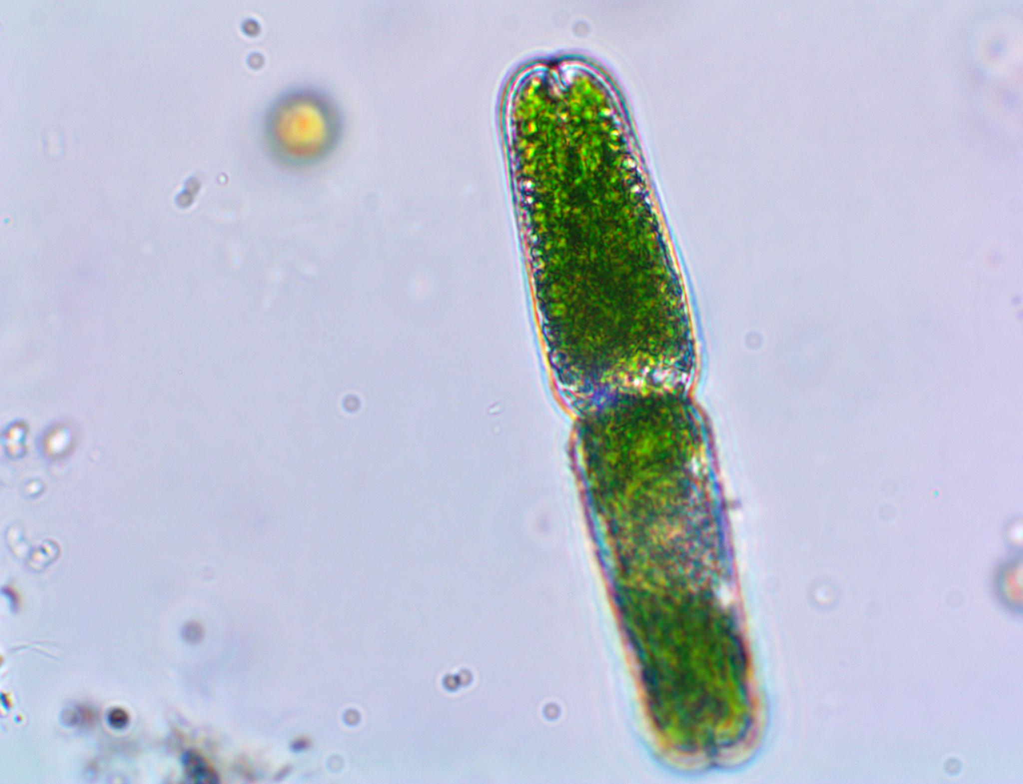 Tetmemorus brebissonii