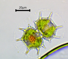 Xanthidium cristatum