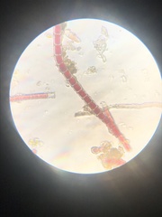 Rhodochorton purpureum