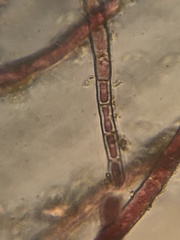 Rhodochorton purpureum