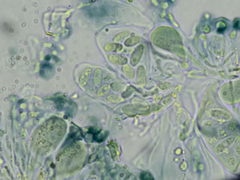 Xylographa parallela