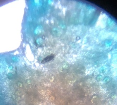 Ascaris lumbricoides