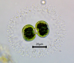 Cosmarium contractum