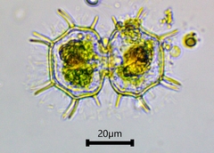 Xanthidium cristatum