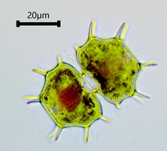 Xanthidium cristatum